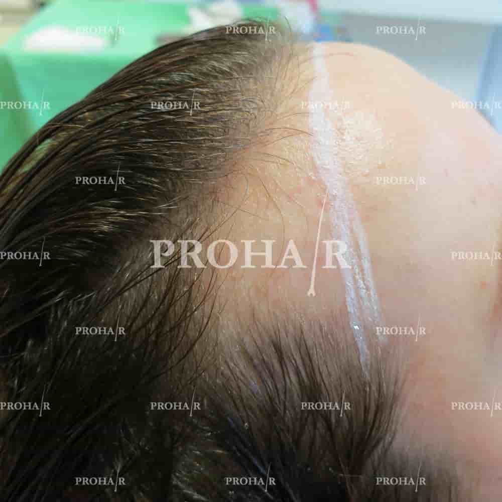 Prohair Klinika Budapest in Budapest, Hungary Reviews from Real Patients Slider image 1