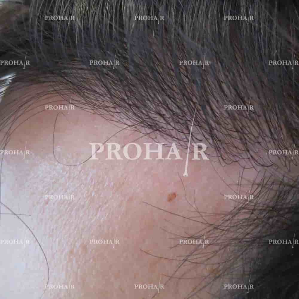 Prohair Klinika Budapest in Budapest, Hungary Reviews from Real Patients Slider image 2