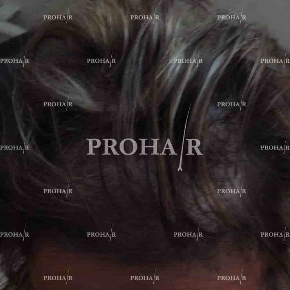 Prohair Klinika Budapest in Budapest, Hungary Reviews from Real Patients Slider image 3