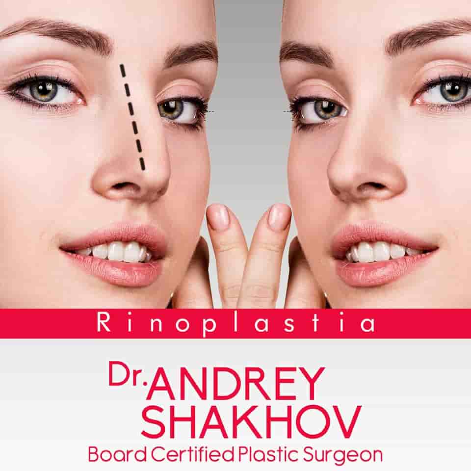 Dr Andrey Shakhov in Tijuana Mexico Reviews From Real Cosmetic Surgery Patients Slider image 7