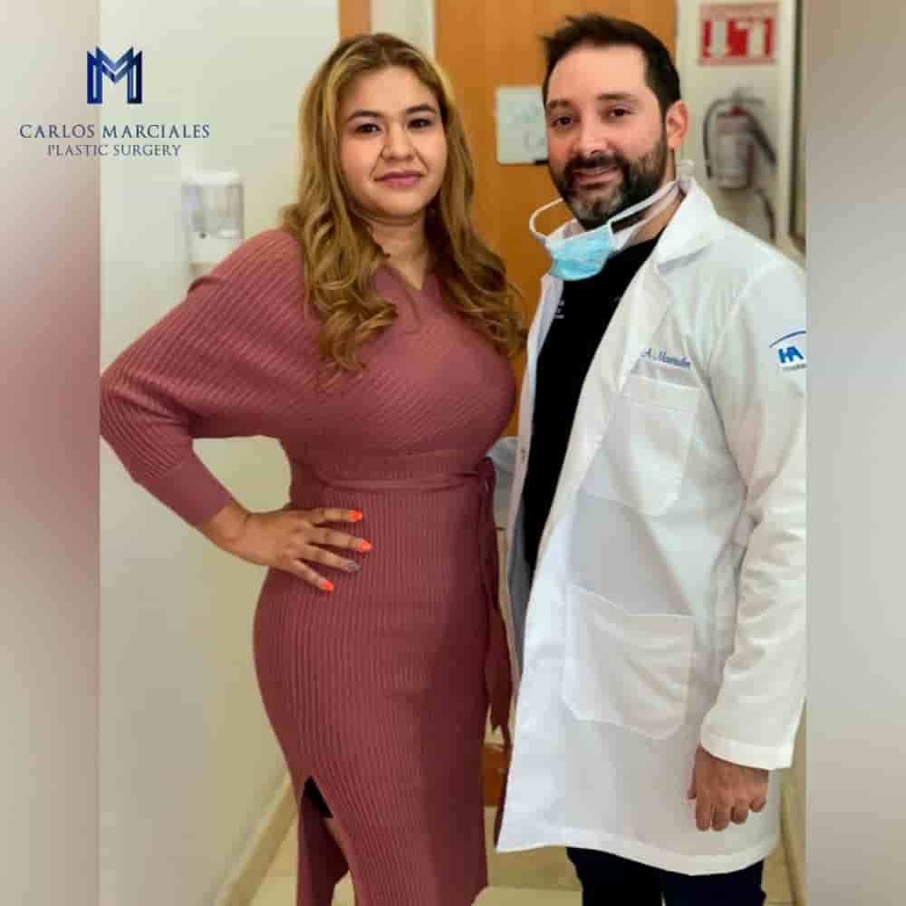 Marciales Plastic Surgery in Tijuana, Mexico Reviews from Real Patients Slider image 6