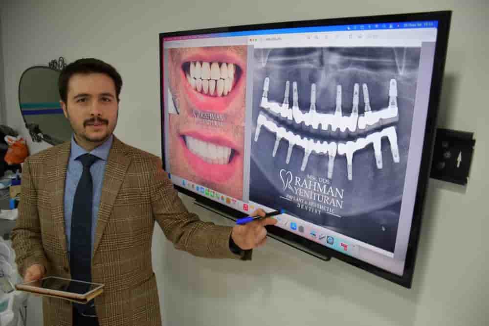 Verified Patients Reviews on Dentistry in Istanbul, Turkey by YKN DENTAL CLINIC
 Slider image 5