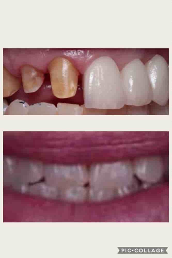 DDS Cinthya Garcia in Los Algodones, Mexico Dentist Reviews of Real Dental Patients Slider image 4