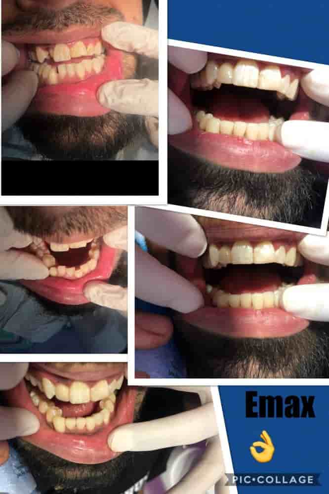 DDS Cinthya Garcia in Los Algodones, Mexico Dentist Reviews of Real Dental Patients Slider image 5