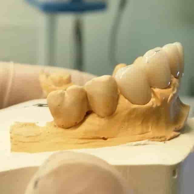 Klinika Dentale Paradent Prishtine in Pristina Kosovo Reviews from Dental Patients Slider image 4