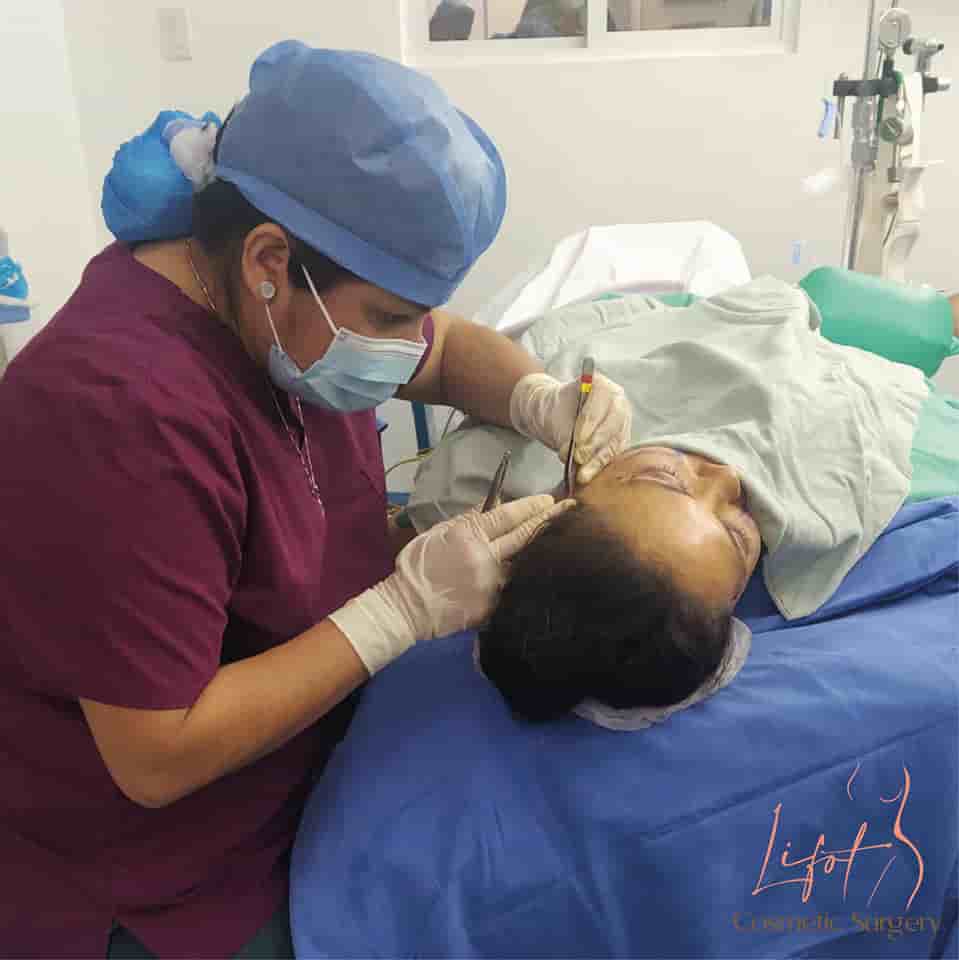 Verified Patients Reviews on Plastic Surgery in Tijuana, Mexico by Lifot Slider image 5