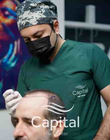 Capital Hair Center Reviews in Istanbul, Turkey by Hair Transplant Patients Slider image 3