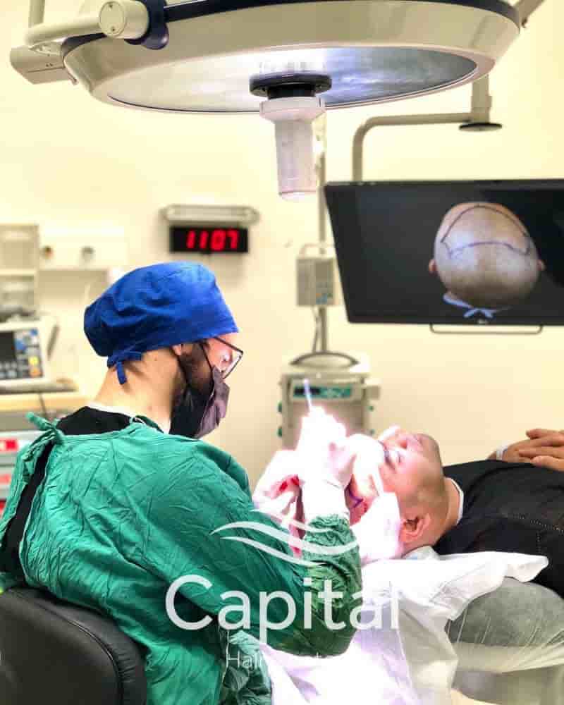 Capital Hair Center Reviews in Istanbul, Turkey by Hair Transplant Patients Slider image 6