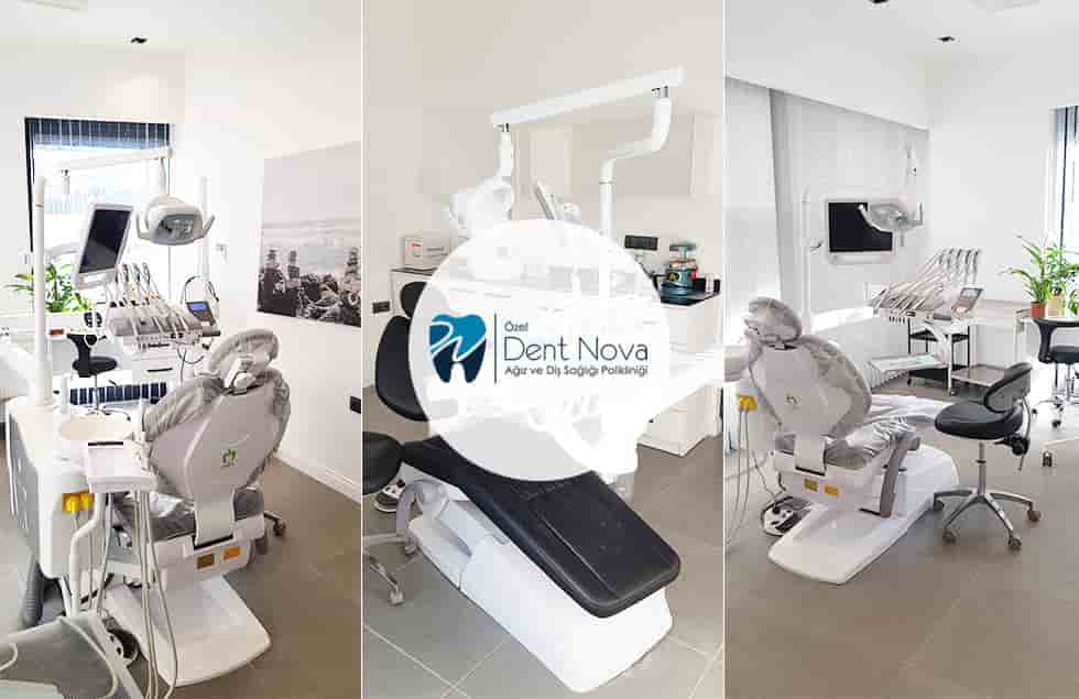 Verified Patients Reviews of Dentistry in Izmir, Turkey by Dent Nova Dental Clinic Slider image 3