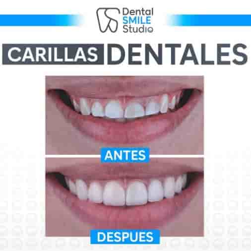 Dental Smile Studio Reviews in Tijuana, Mexico Slider image 1