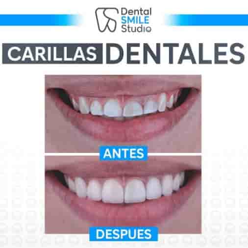 Dental Smile Studio Reviews in Tijuana, Mexico Slider image 1