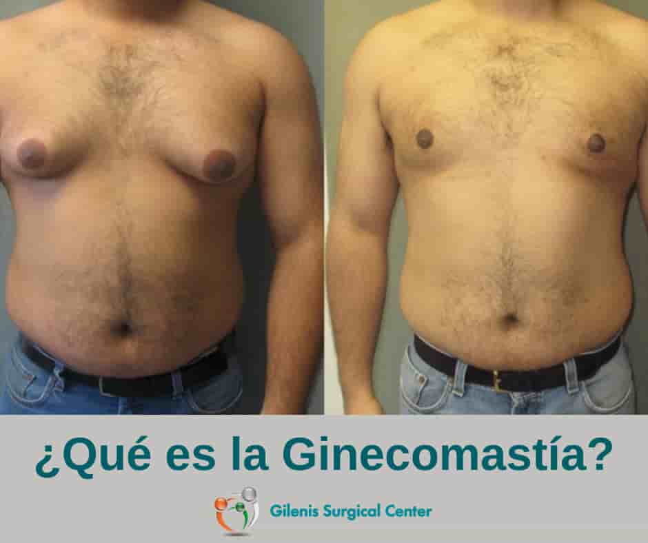 Gilenis Surgical Center Reviews in Tijuana, Mexico Slider image 5