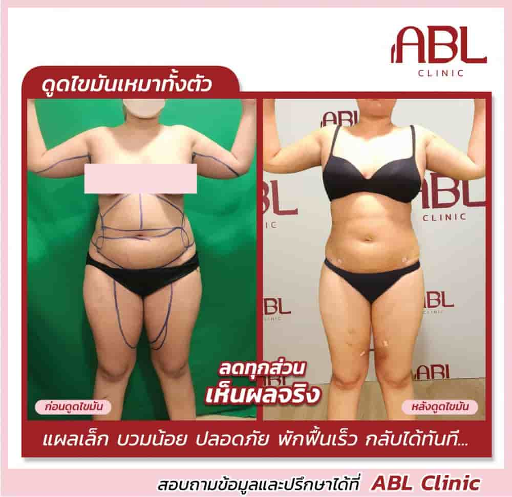 DGB Plastic Surgery Clinic Reviews in Bangkok, Thailand Slider image 2