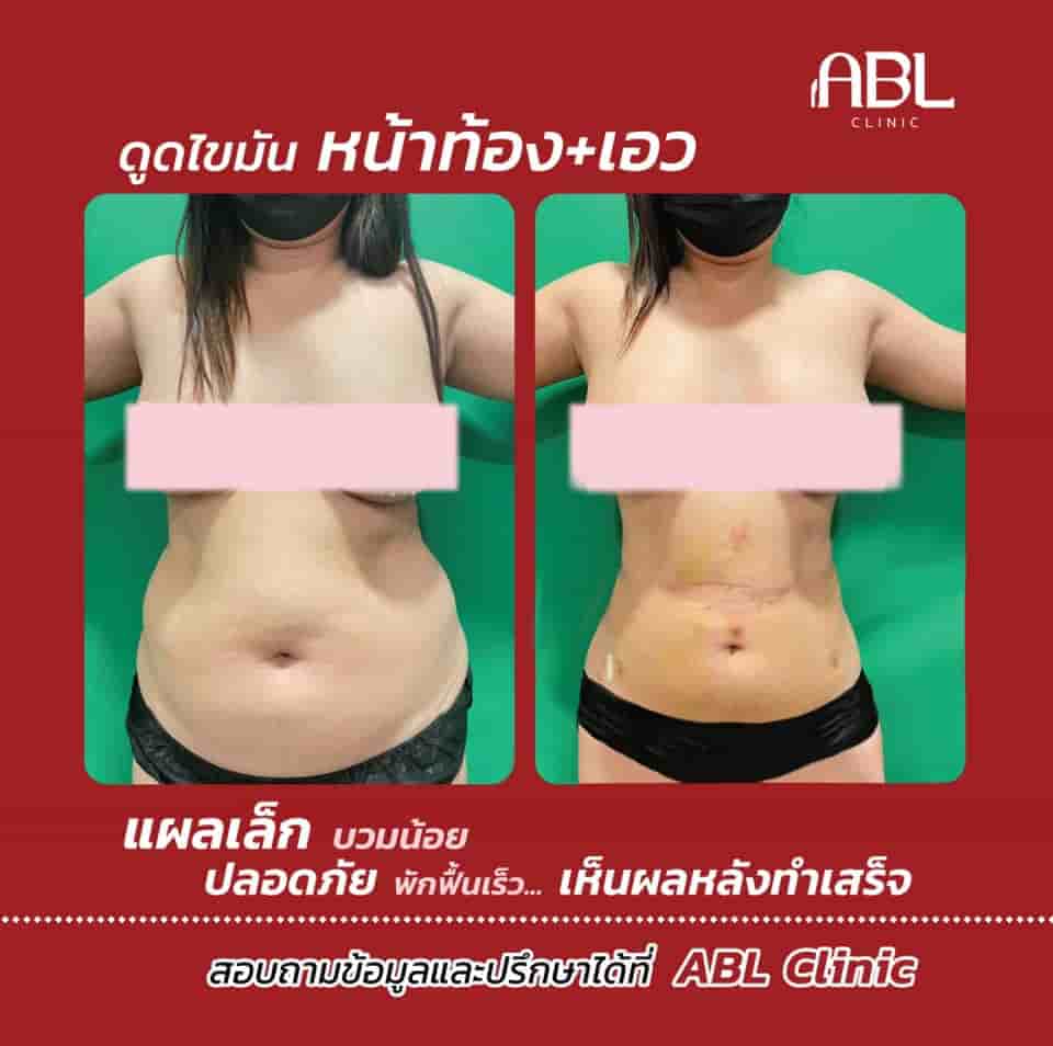 DGB Plastic Surgery Clinic Reviews in Bangkok, Thailand Slider image 3