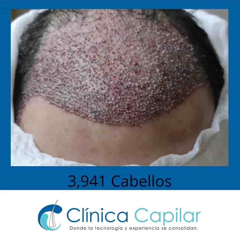 Clinica Capilar Reviews in Santiago de los Caballeros, Dominican Republic Slider image 6