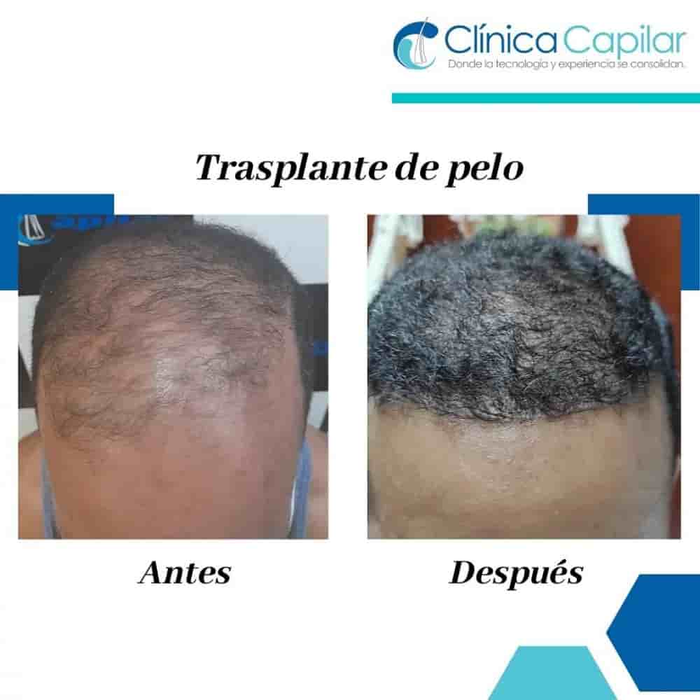 Clinica Capilar Reviews in Santiago de los Caballeros, Dominican Republic Slider image 7