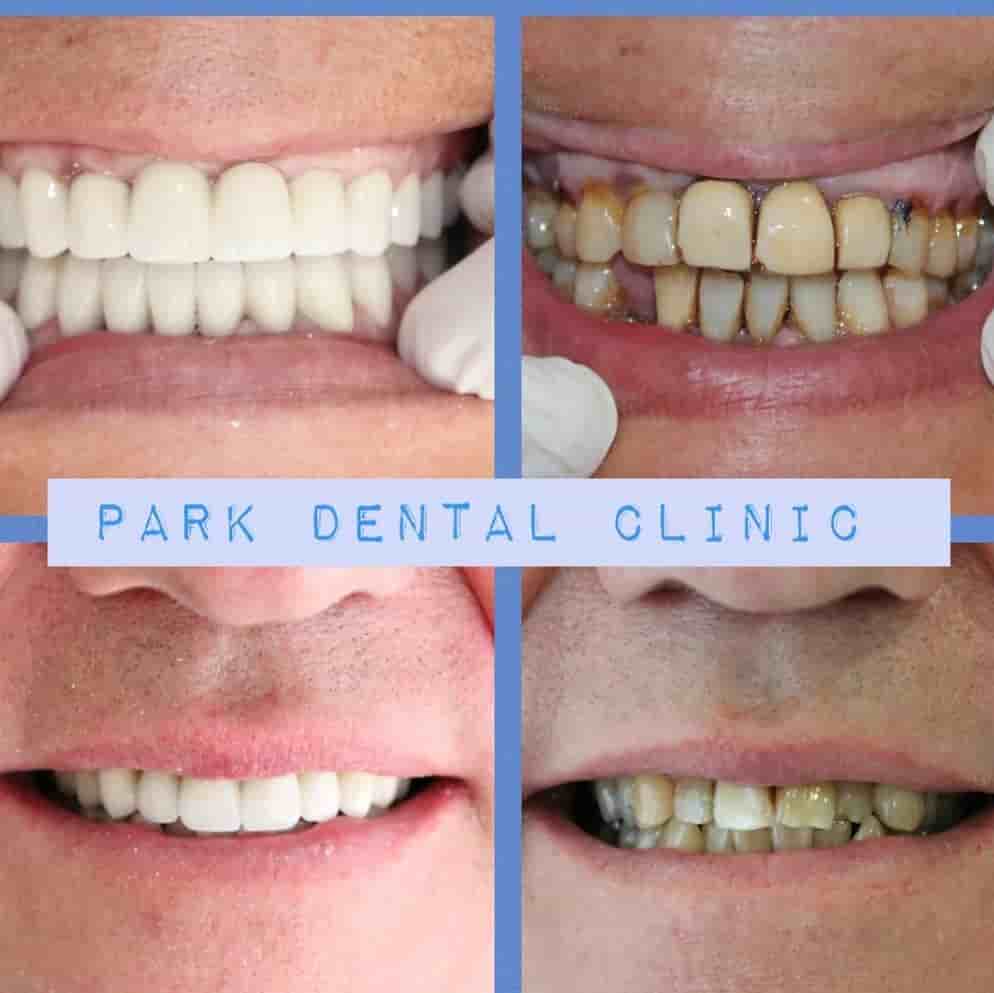 Park Dental Clinic Reviews in Aydin, Turkey Slider image 6