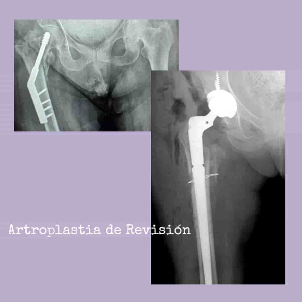 Dr. Rodrigo Aguirre Rojas Orthopedic Surgeon Reviews in San Jose del Cabo, Mexico Slider image 1