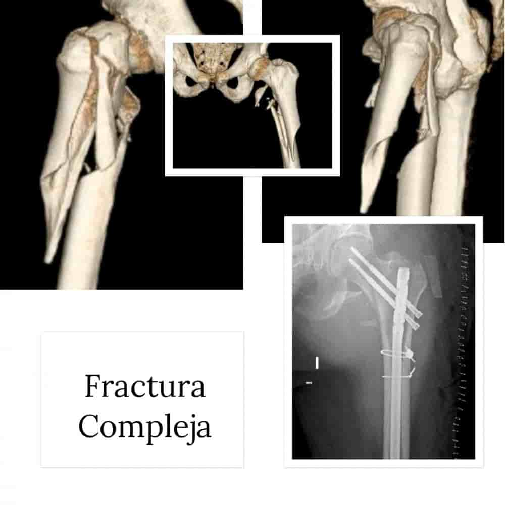 Dr. Rodrigo Aguirre Rojas Orthopedic Surgeon Reviews in San Jose del Cabo, Mexico Slider image 2