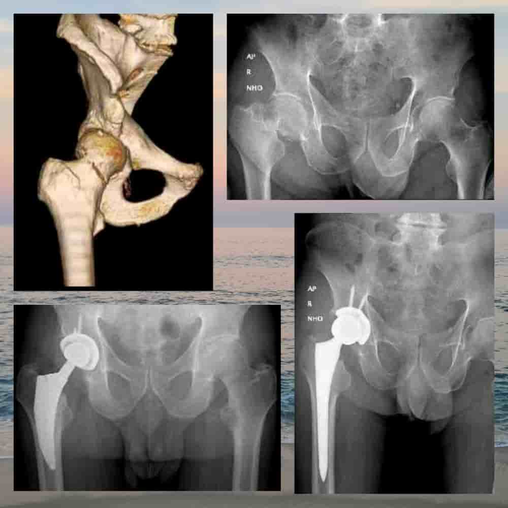 Dr. Rodrigo Aguirre Rojas Orthopedic Surgeon Reviews in San Jose del Cabo, Mexico Slider image 8