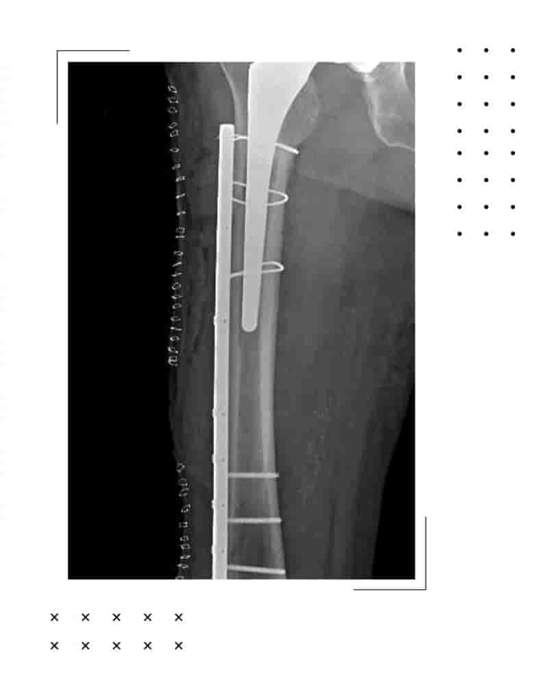Dr. Rodrigo Aguirre Rojas Orthopedic Surgeon Reviews in San Jose del Cabo, Mexico Slider image 9