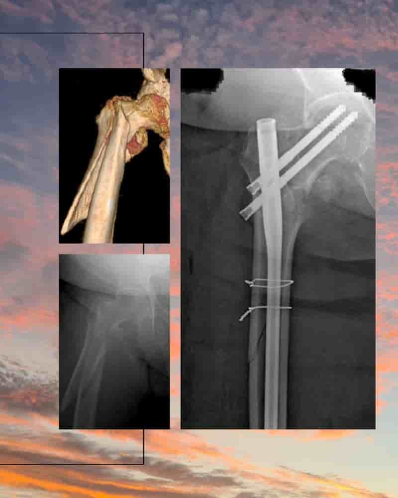 Dr. Rodrigo Aguirre Rojas Orthopedic Surgeon Reviews in San Jose del Cabo, Mexico Slider image 10