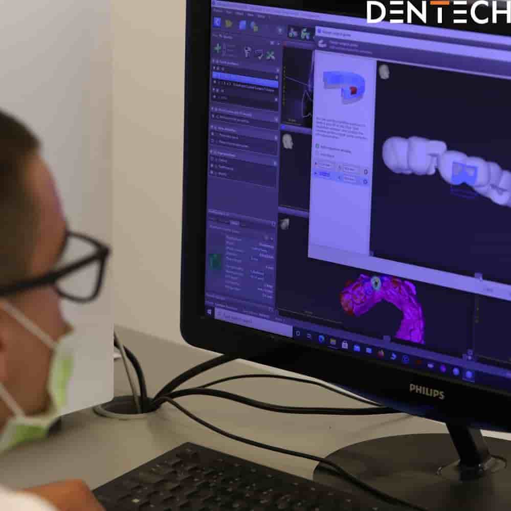 Dentech Dental Centar Reviews in Split, Croatia Slider image 8