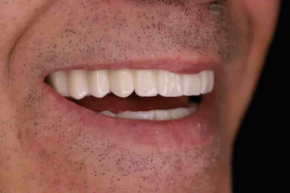 Dentech Dental Centar Reviews in Split, Croatia Slider image 6