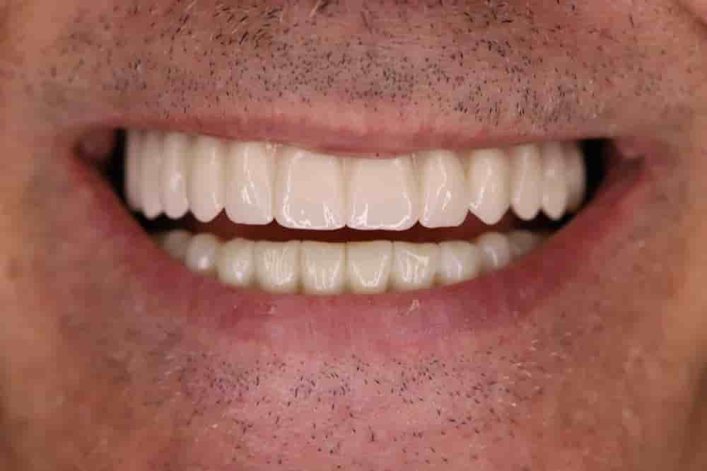 Dentech Dental Centar Reviews in Split, Croatia Slider image 7