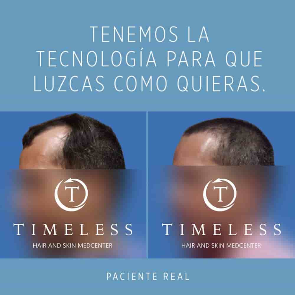 Timeless Hair & Skin Medcenter in Mexicali, Mexico Reviews from Real Patients Slider image 2