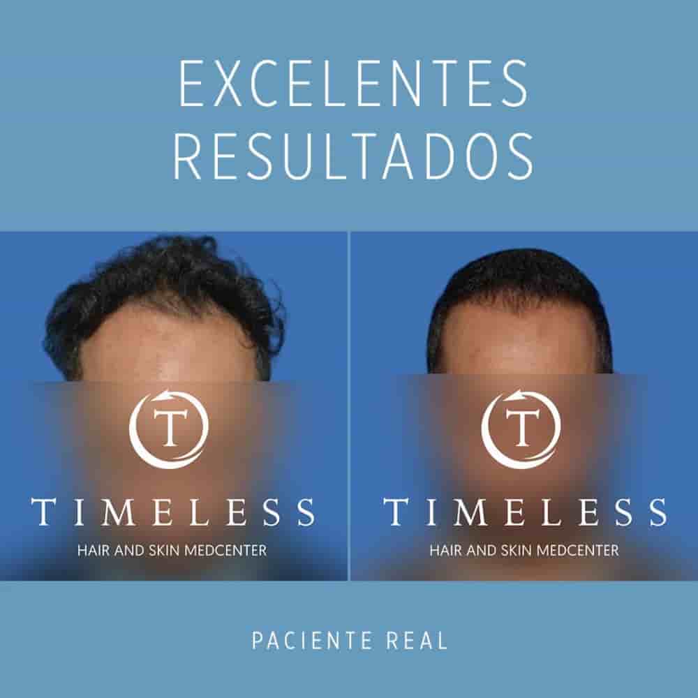 Timeless Hair & Skin Medcenter in Mexicali, Mexico Reviews from Real Patients Slider image 3