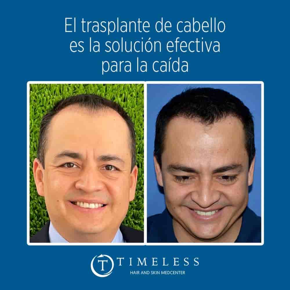Timeless Hair & Skin Medcenter in Mexicali, Mexico Reviews from Real Patients Slider image 6