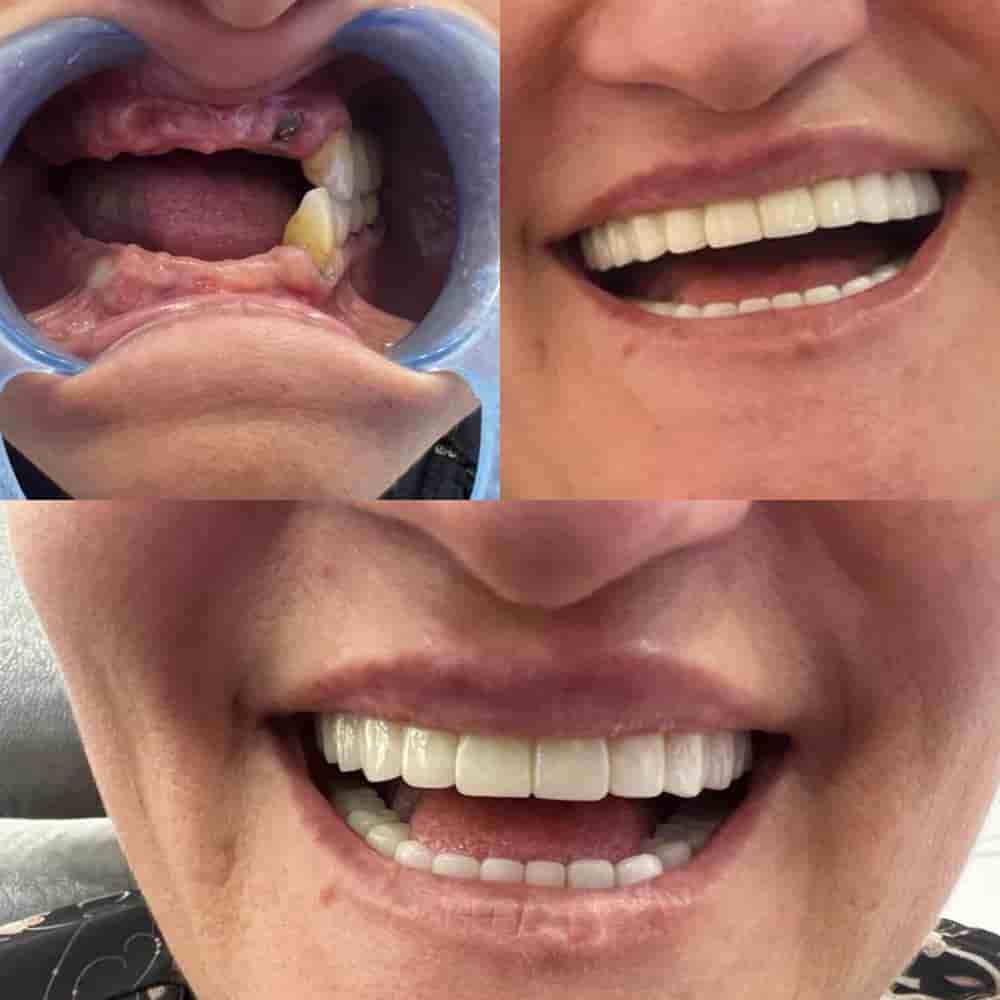 Zirve Dental Reviews in Aydin, Turkey Slider image 1