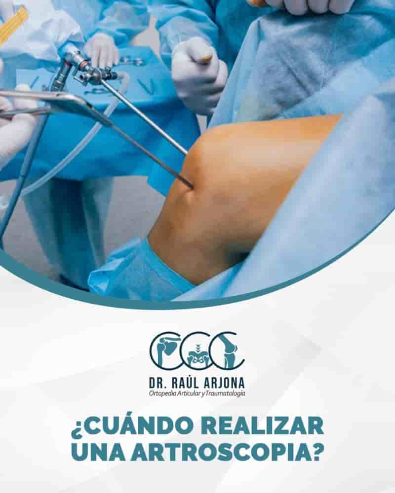 Orthopaedics Art by Dr. Jesus Raul Arjona Alcocer in Cancun, Mexico Reviews from Real Patients Slider image 1