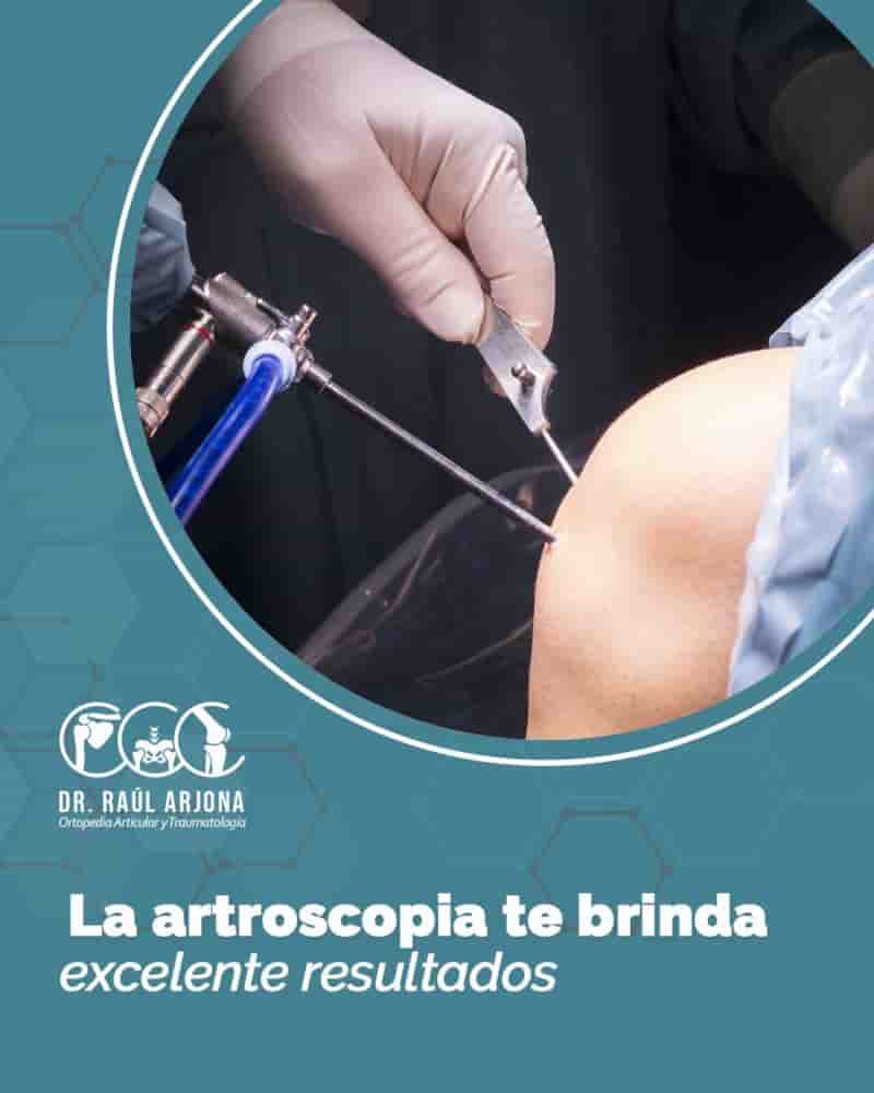 Orthopaedics Art by Dr. Jesus Raul Arjona Alcocer in Cancun, Mexico Reviews from Real Patients Slider image 2