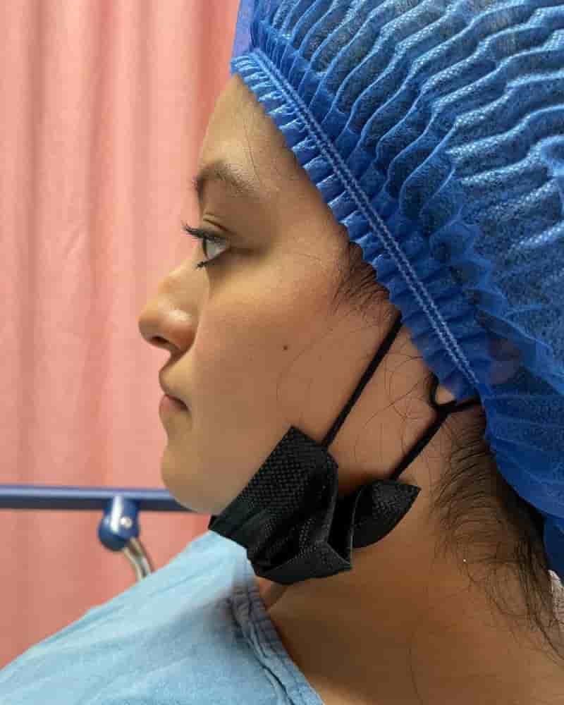 Aesthetic and Oncologic Face, Head and Neck Clinic and OR in Tijuana, Mexico Reviews from Real Patients Slider image 5