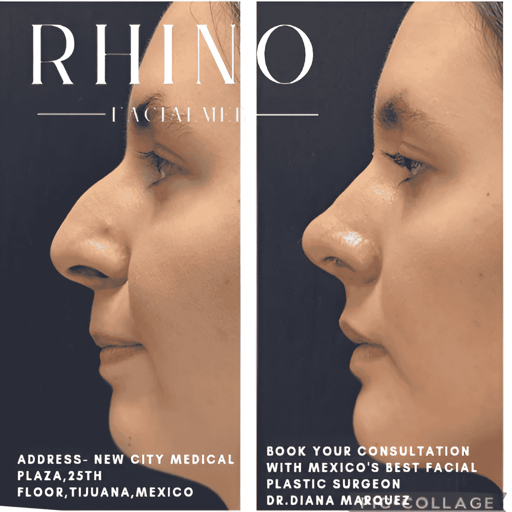 Aesthetic and Oncologic Face, Head and Neck Clinic and OR in Tijuana, Mexico Reviews from Real Patients Slider image 4