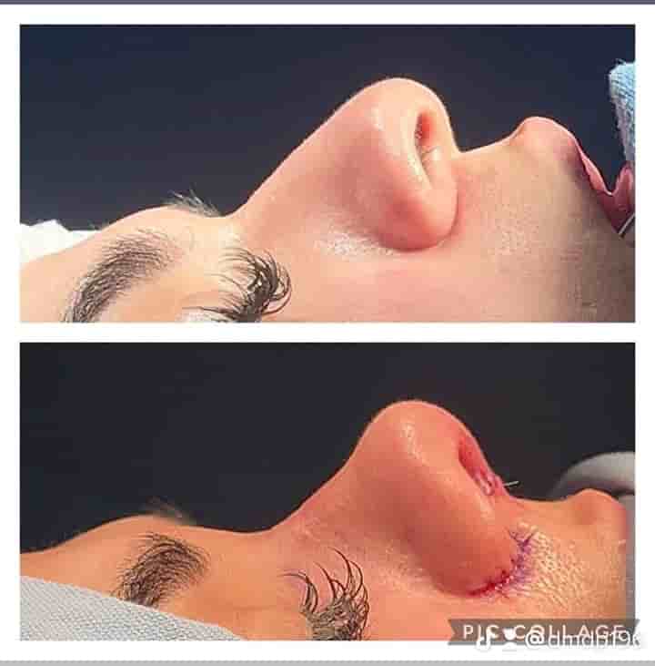 Aesthetic and Oncologic Face, Head and Neck Clinic and OR in Tijuana, Mexico Reviews from Real Patients Slider image 5