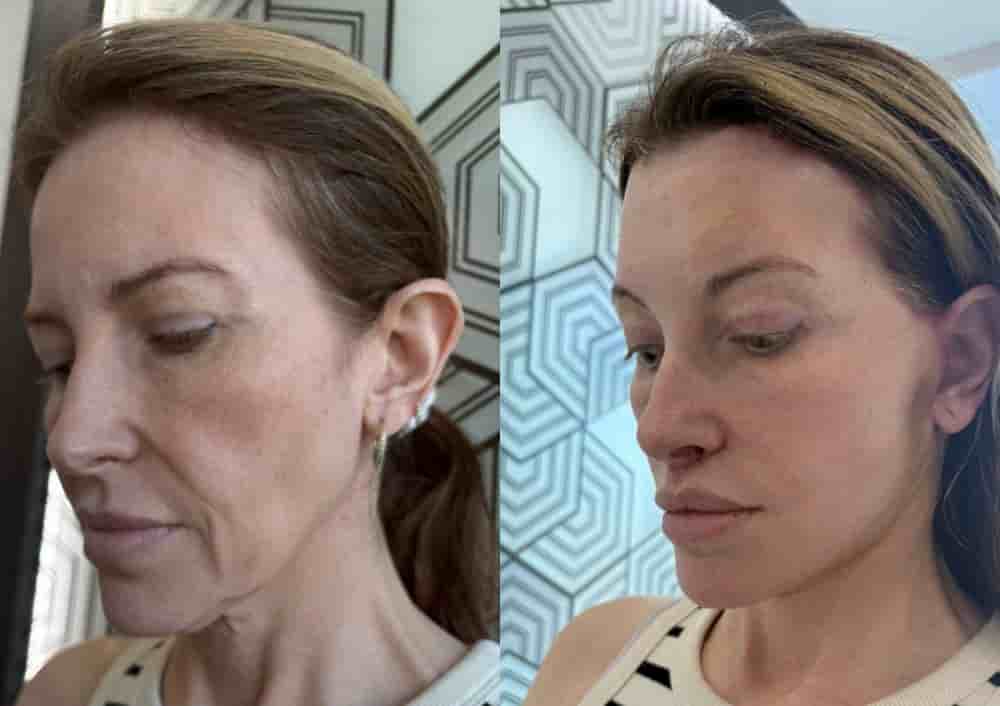 Aesthetic and Oncologic Face, Head and Neck Clinic and OR in Tijuana, Mexico Reviews from Real Patients Slider image 2