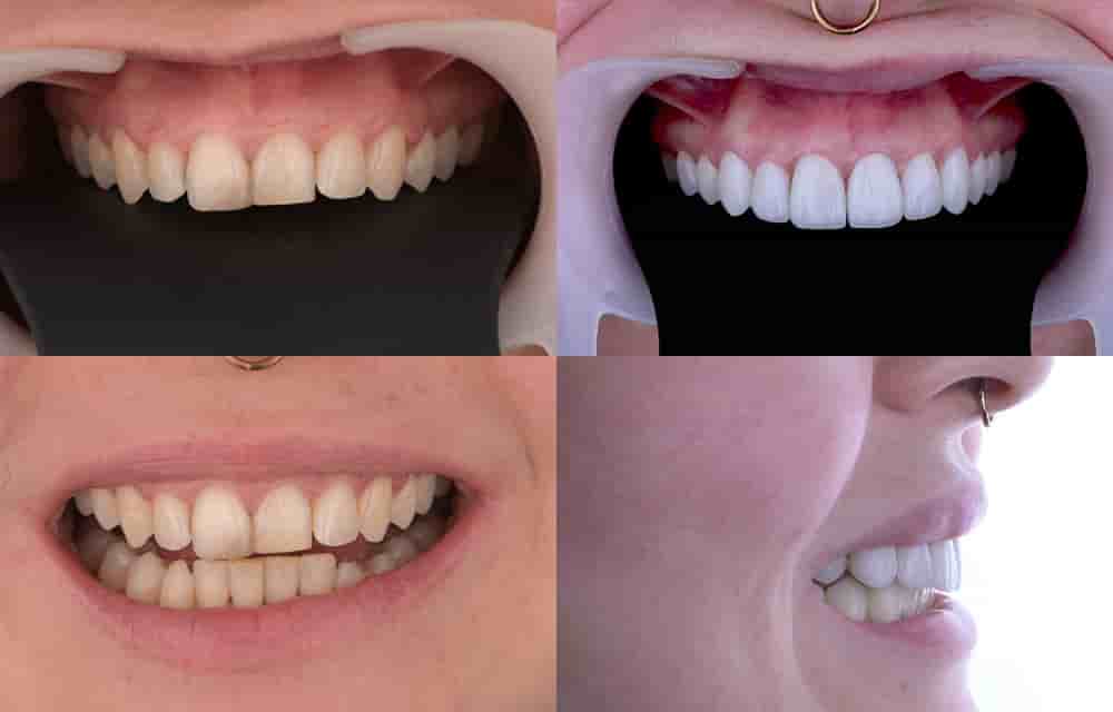 Dentleon Polyclinics in Izmir, Turkey Reviews from Real Patients Slider image 4