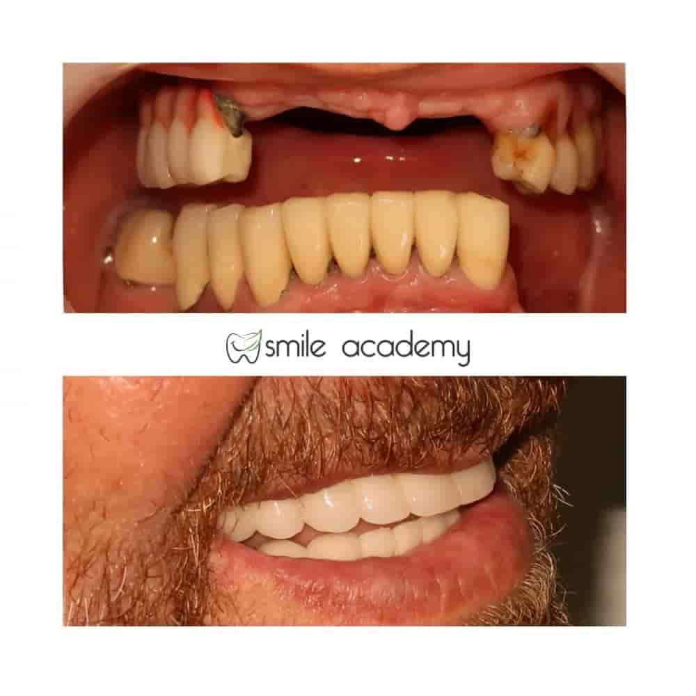 Esthetic Smile Academy  in Istanbul, Turkey Reviews from Real Patients Slider image 2