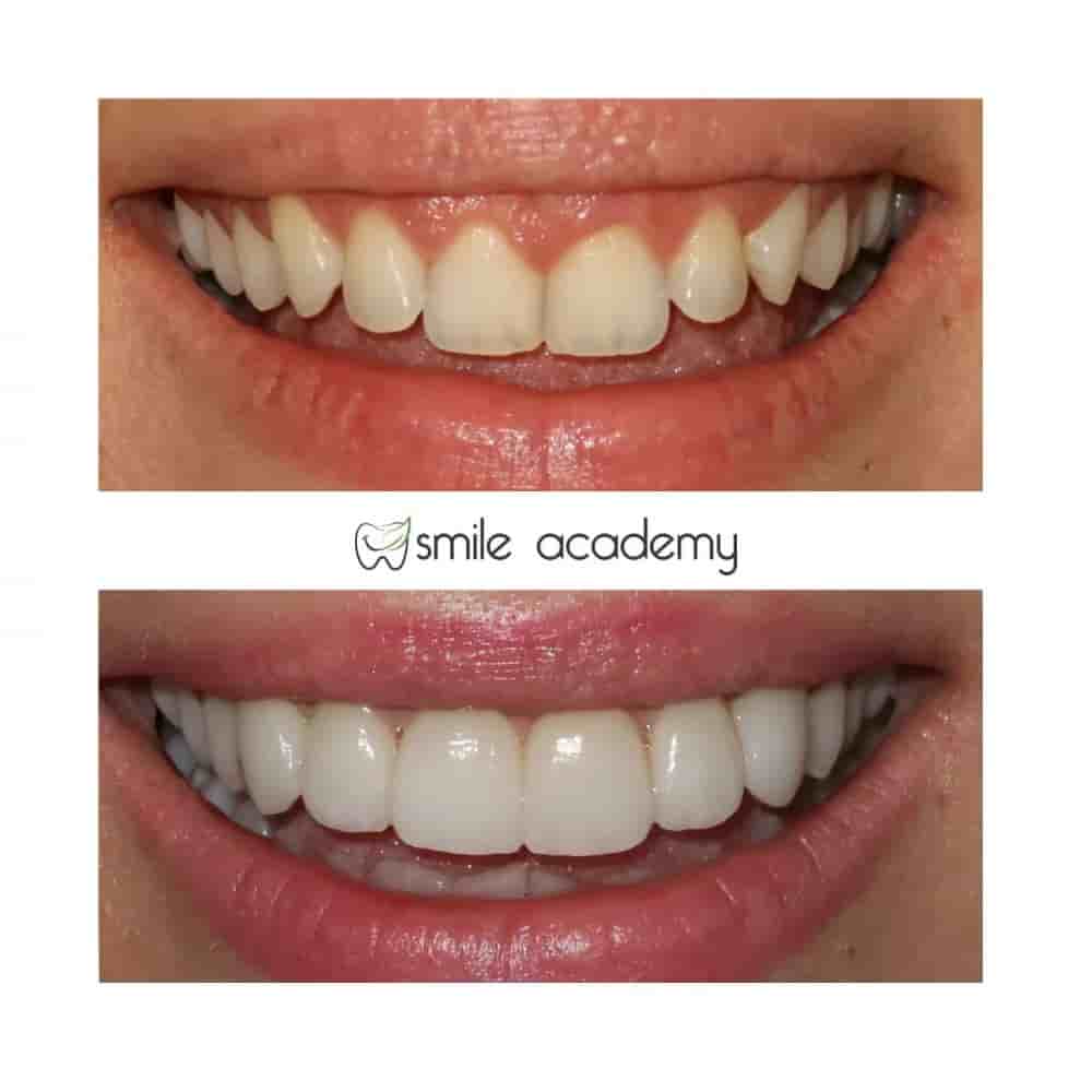 Esthetic Smile Academy  in Istanbul, Turkey Reviews from Real Patients Slider image 4