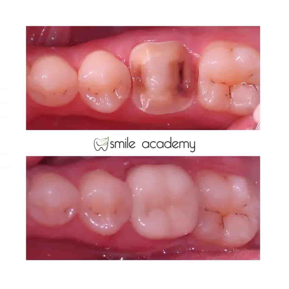 Esthetic Smile Academy  in Istanbul, Turkey Reviews from Real Patients Slider image 7