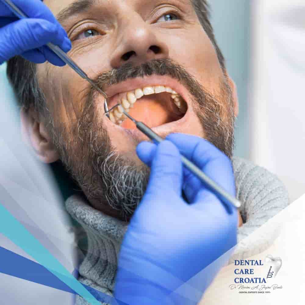 Dental Care Croatia in Split, Croatia Reviews from Real Patients Slider image 7