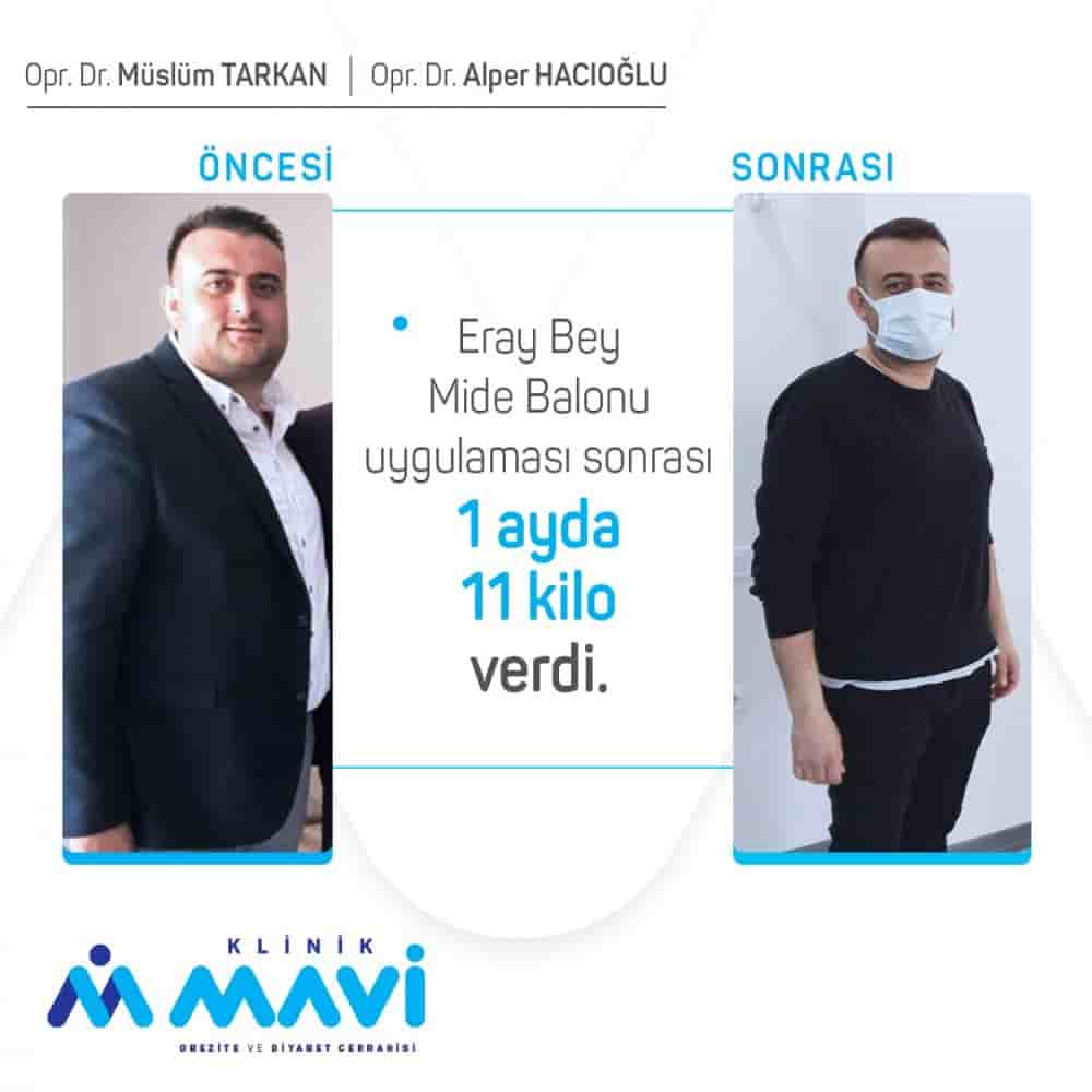 Klinik Mavi in Eskisehir, Turkey Reviews from Real Patients Slider image 1
