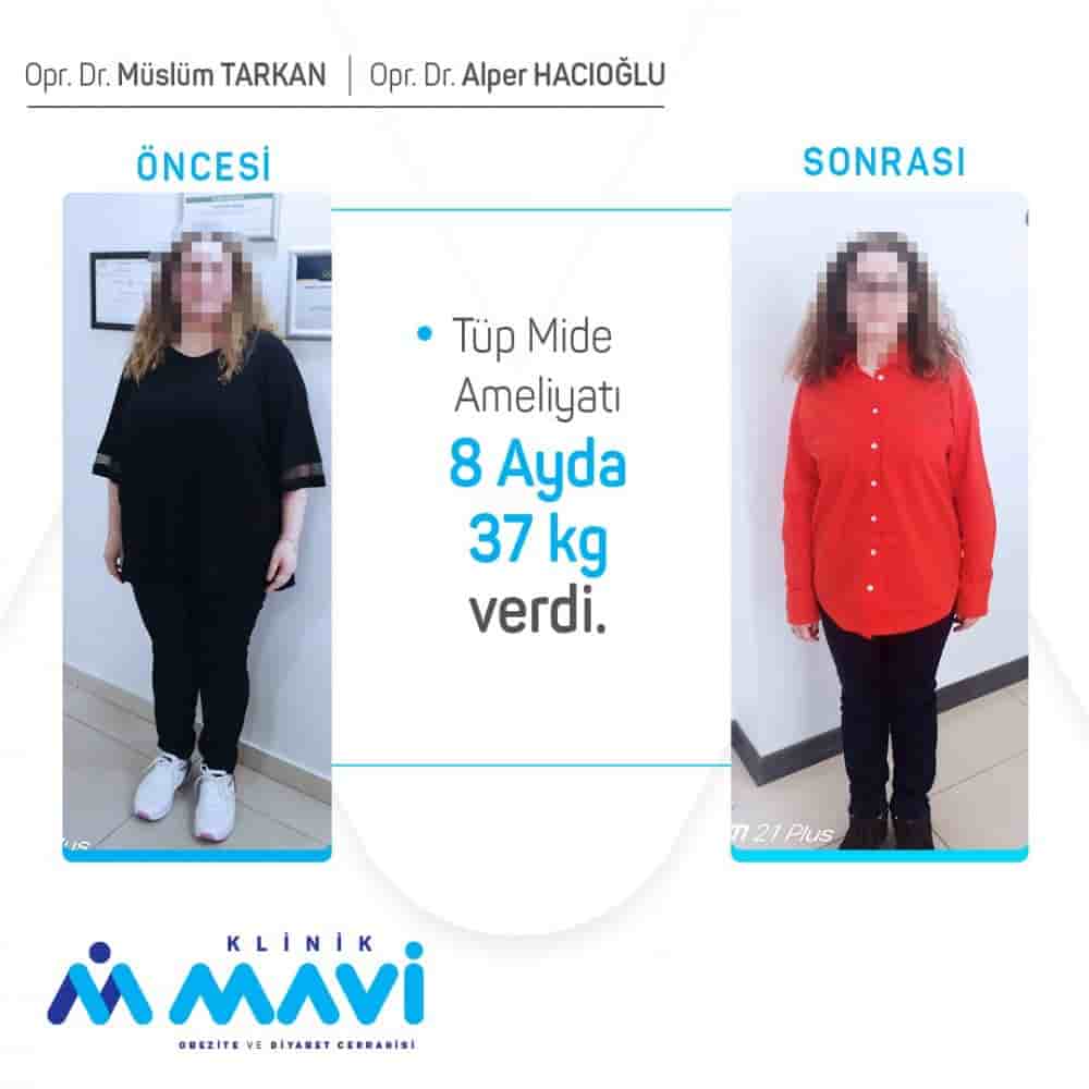 Klinik Mavi in Eskisehir, Turkey Reviews from Real Patients Slider image 3