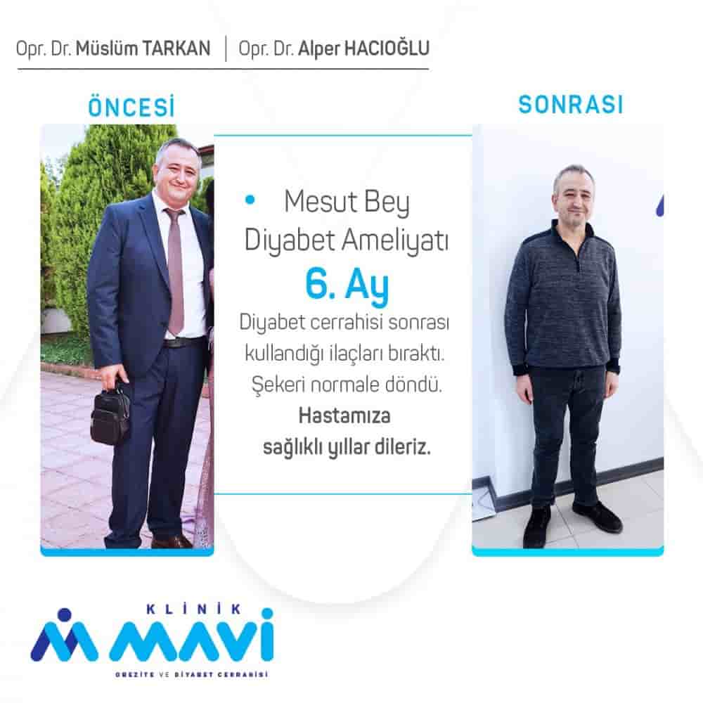 Klinik Mavi in Eskisehir, Turkey Reviews from Real Patients Slider image 4