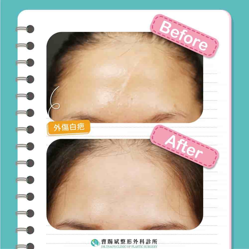 Dr. Tsao Clinic of Plastic Surgery in Taipei, Taiwan Reviews from Real Patients Slider image 3