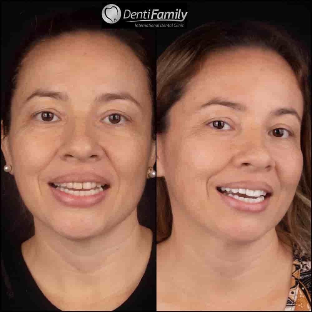 DENTIFAMILY in Bucaramanga, Colombia Reviews from Real Patients Slider image 9