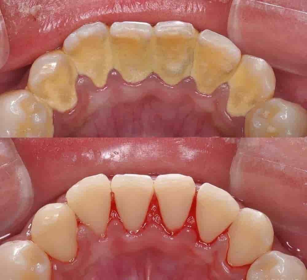 Nairobi Sterling Dental Clinic in Nairobi, Kenya Reviews from Real Patients Slider image 2